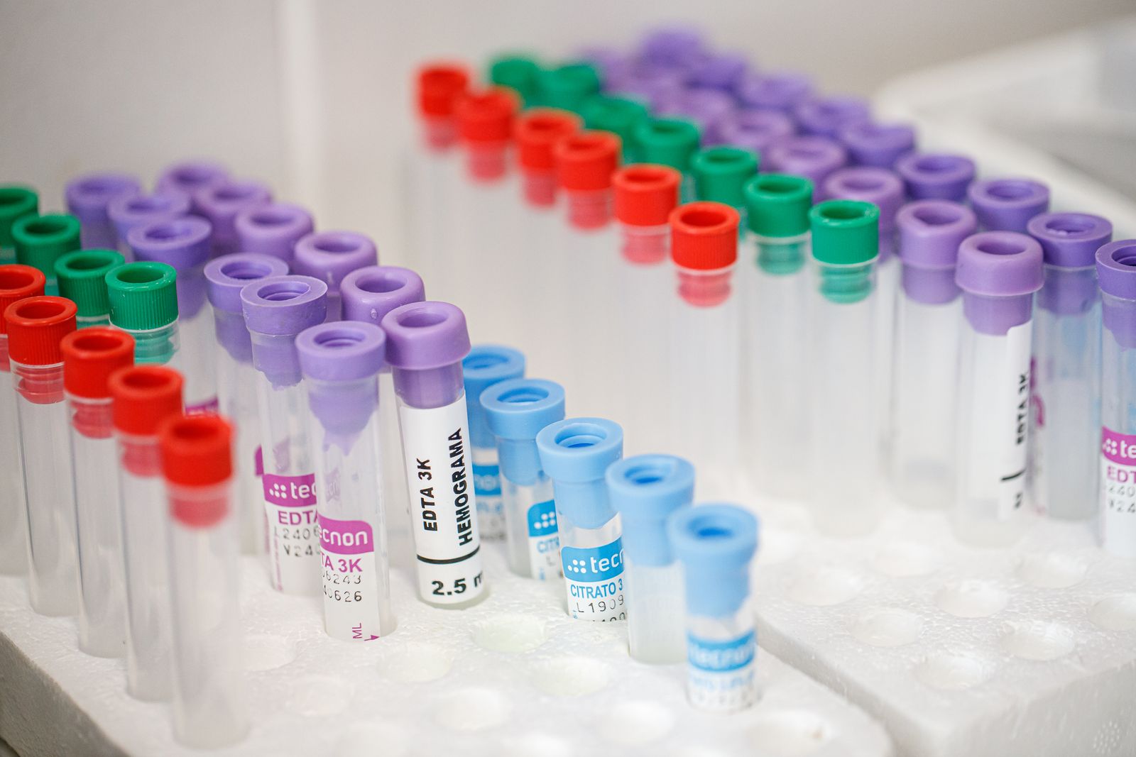Cómo prepararte para un análisis de sangre